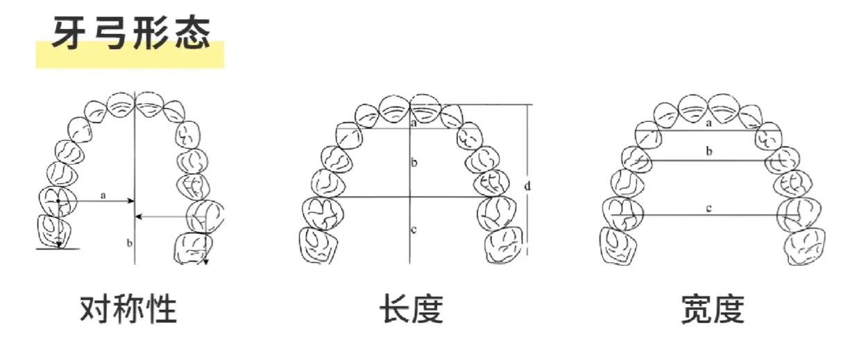 正畸牙弓长度预测方法有何科学依据？-图1