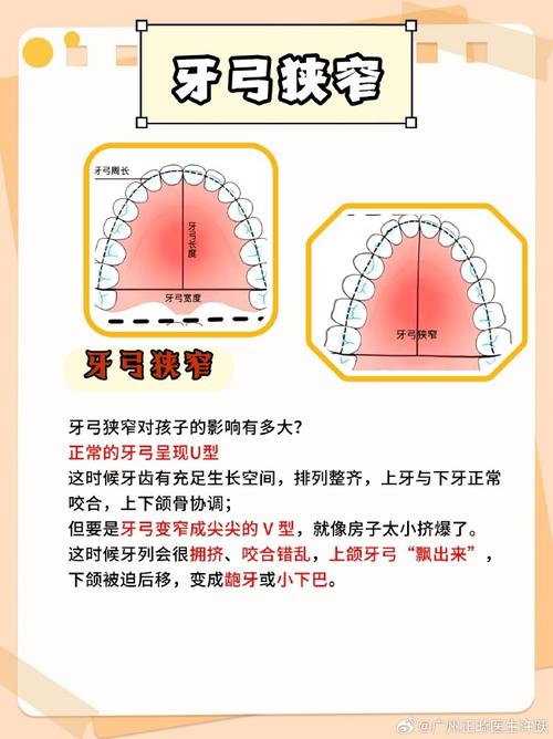 正畸牙弓长度预测方法有何科学依据？-图3