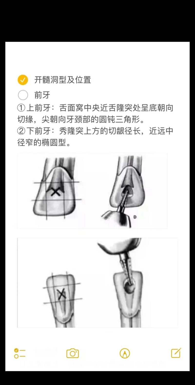 下前牙开髓的临床操作方法与技巧有哪些？-图1