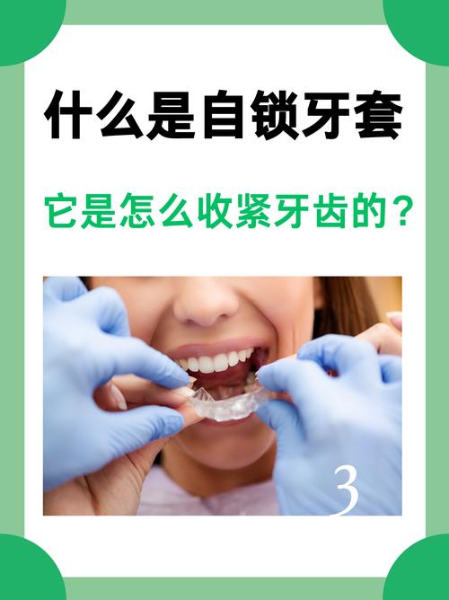 如何正确佩戴牙套？新手必学步骤与注意事项-图1