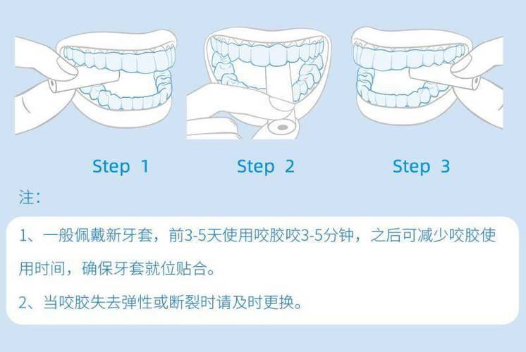 如何正确佩戴牙套？新手必学步骤与注意事项-图3