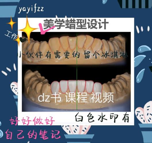 如何精准掌握备牙肩台的操作方法？-图1