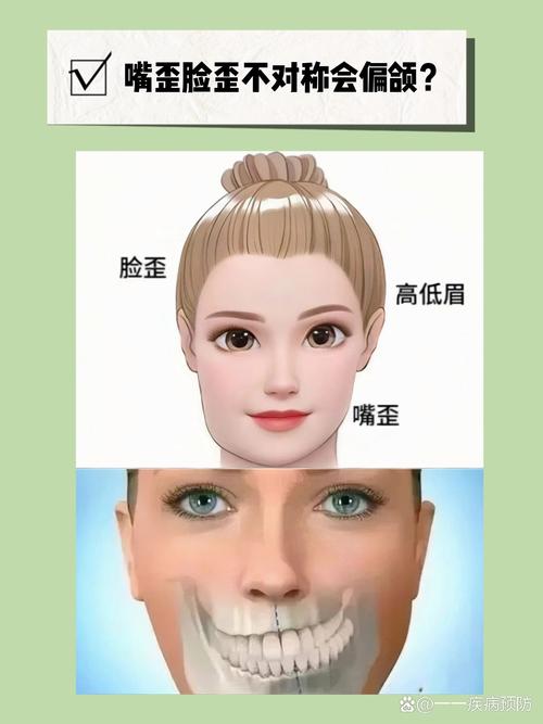 脸型不对称如何矫正?有哪些有效方法推荐?-图2 脸型不对称如何矫正?有哪些有效方法推荐?-图2