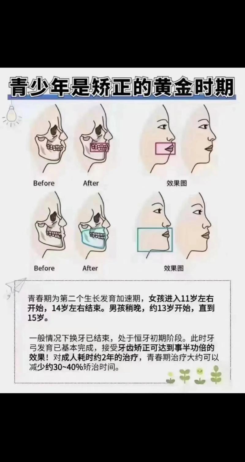 脸型不对称如何矫正?有哪些有效方法推荐?-图1 脸型不对称如何矫正?有哪些有效方法推荐?-图1