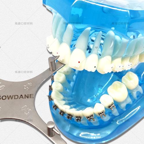口腔正畸托槽定位模板如何提升矫正精准度?-图2 口腔正畸托槽定位模板如何提升矫正精准度?-图2
