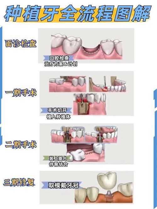种牙对牙间距的具体要求是什么？-图1