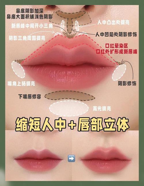 下牙唇倾的矫正方法有哪些？哪种适合不同情况？-图2