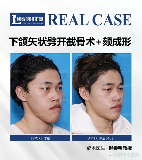 Damon张慧男正畸效果如何？技术优势有哪些？-图2