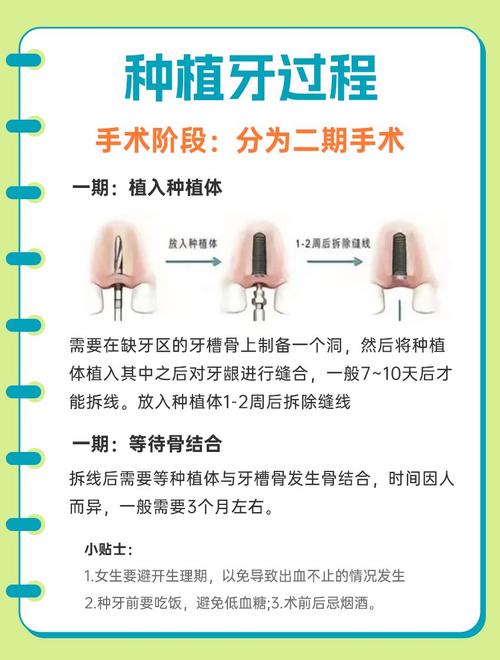 种植牙最短方法是什么？多久能完成？-图3