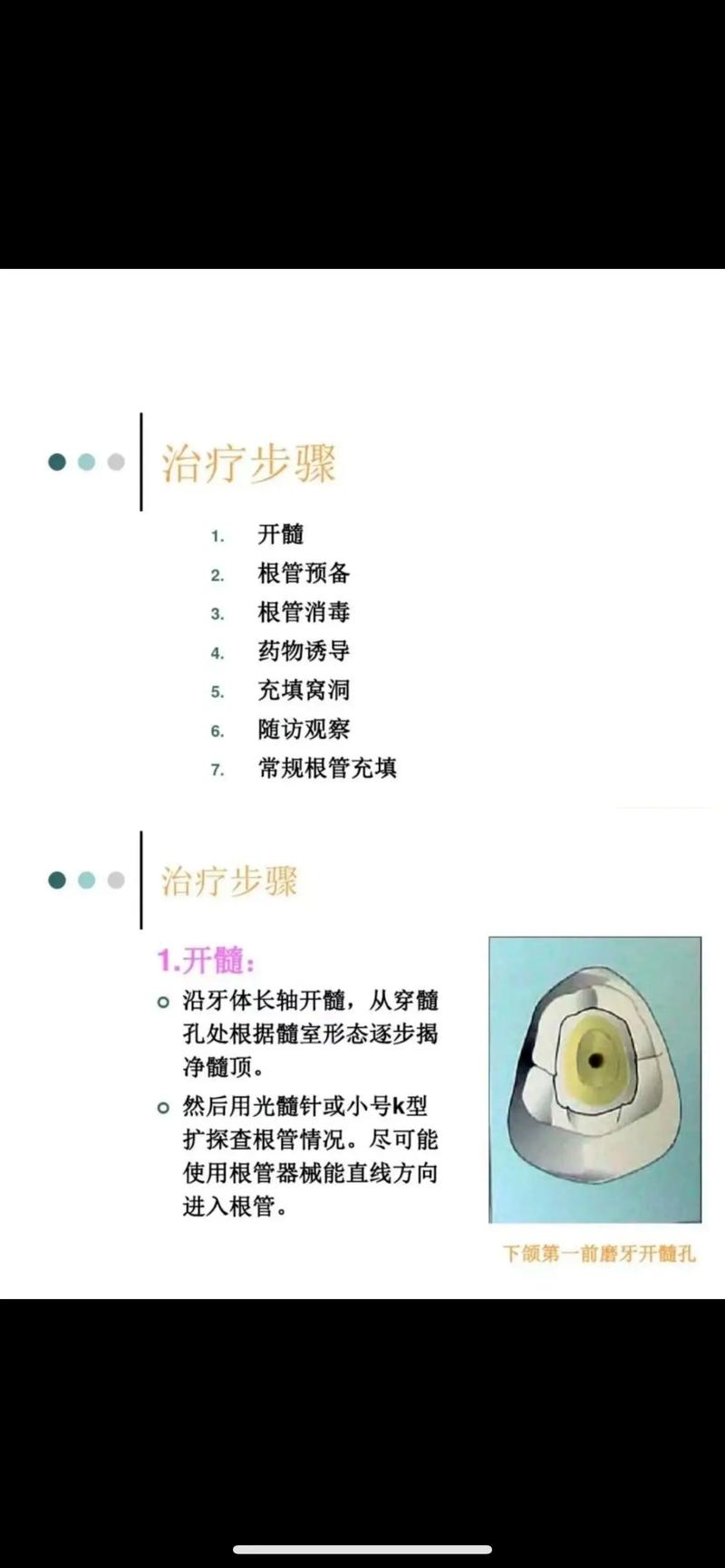 口腔科治疗方法有哪些？如何根据症状选择？-图2