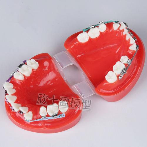 口腔正畸模型制取需满足哪些关键要求？-图3