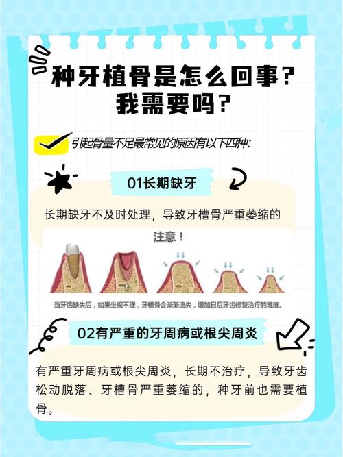 牙骨太短怎么种牙-图3 牙骨太短怎么种牙-图3