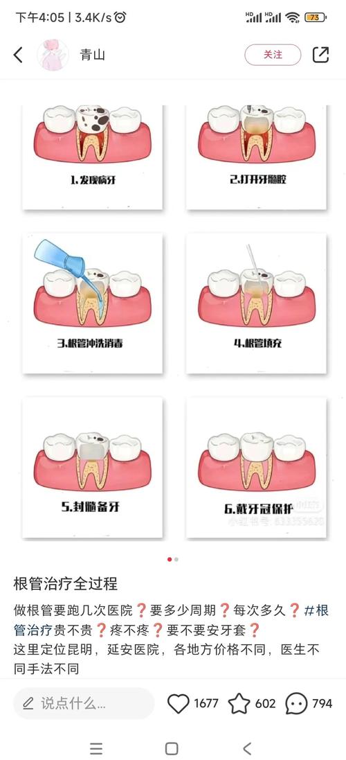 拔门牙牙根的具体方法有哪些？-图2