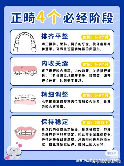 错颌正畸方法有哪些？如何选择适合自己的？-图3