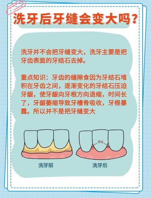 不正规洗牙方法为何会带来口腔健康风险？-图1