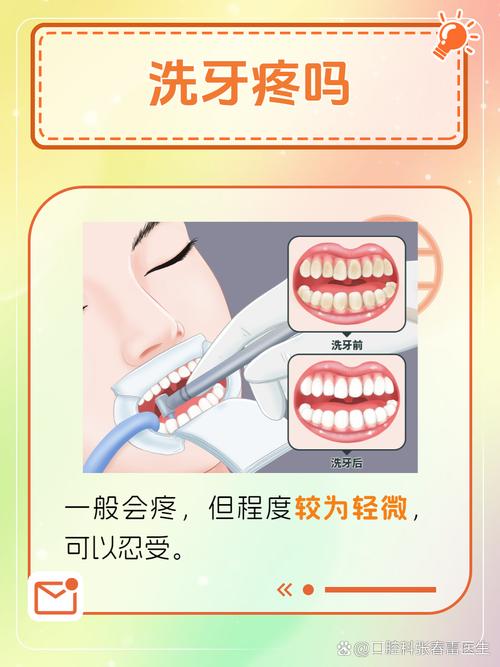 不正规洗牙方法为何会带来口腔健康风险？-图2