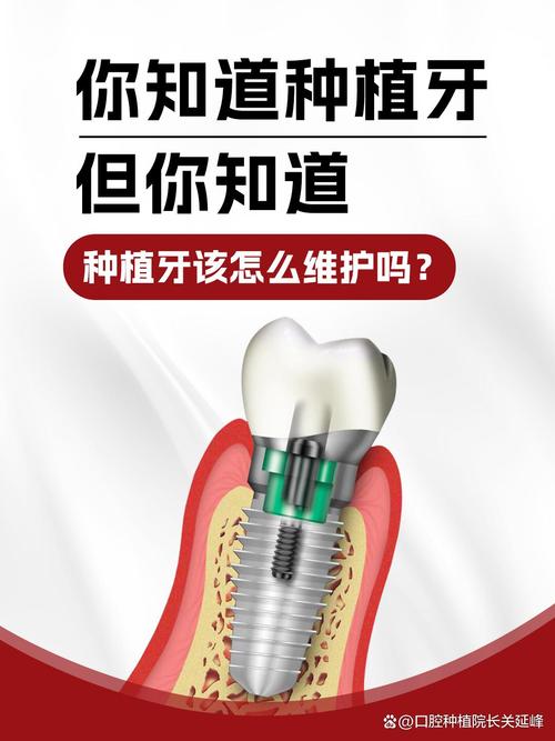 种牙植骨手术后,一般多久可以拆线?-图2 种牙植骨手术后,一般多久可以拆线?-图2