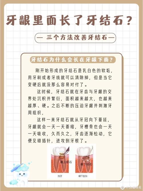 怎样有效去除牙石？正确方法有哪些步骤和技巧？-图2