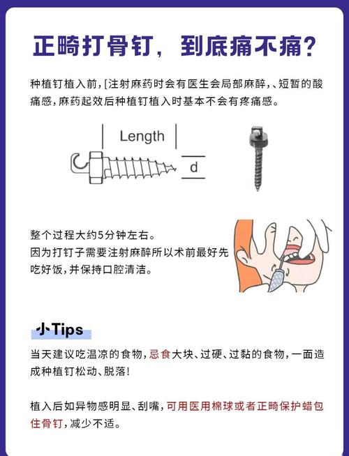 如何科学选择正畸带环的合适大小？-图2