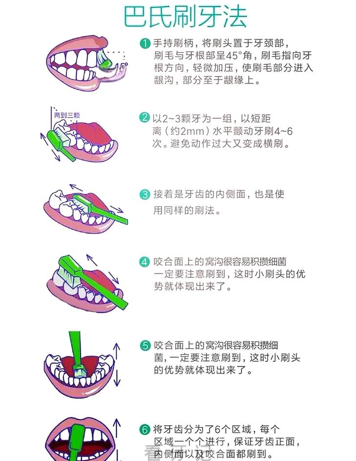 治牙方法及步骤-图2