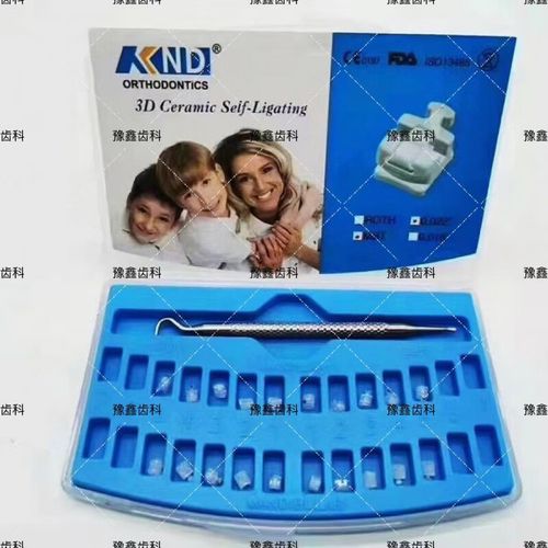 正畸陶瓷托槽彩色标志如何提升正畸精准度与美观度？-图2