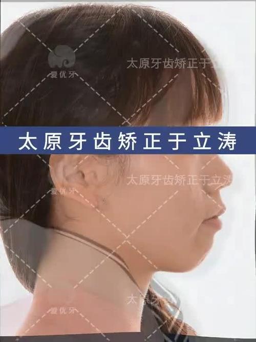 光华正畸学堂系列课程，如何系统提升正畸专业技能？-图3