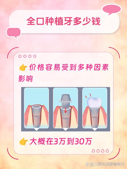 北大口腔种牙费用贵不贵？具体价格究竟如何？-图3