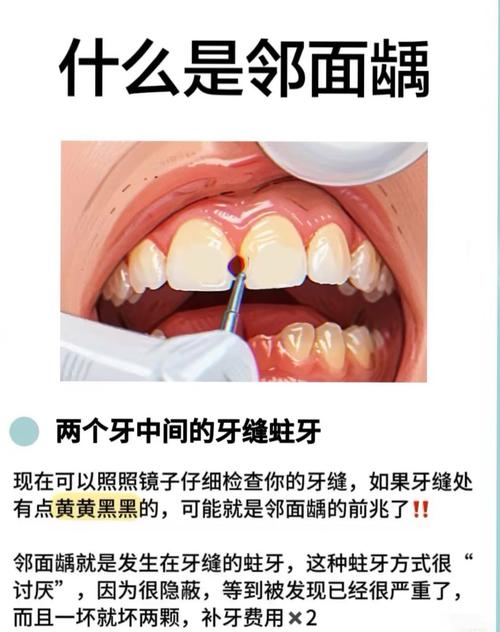 正畸矫正后牙齿发黑，如何有效去除？-图1