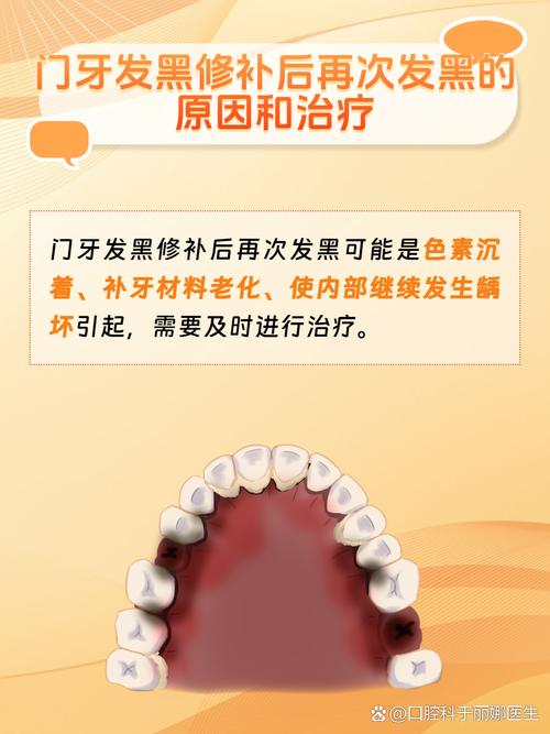 正畸矫正后牙齿发黑，如何有效去除？-图3