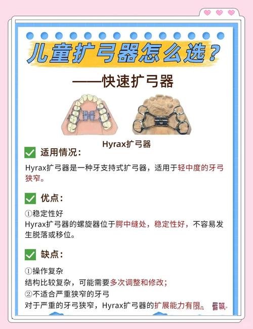 矫牙方法有哪些？不同方法各有什么优点？-图1