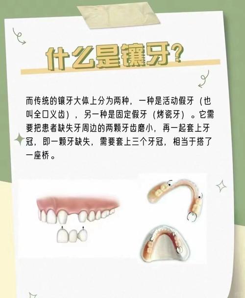 镶活动牙的方法是什么？有哪些操作步骤？-图2