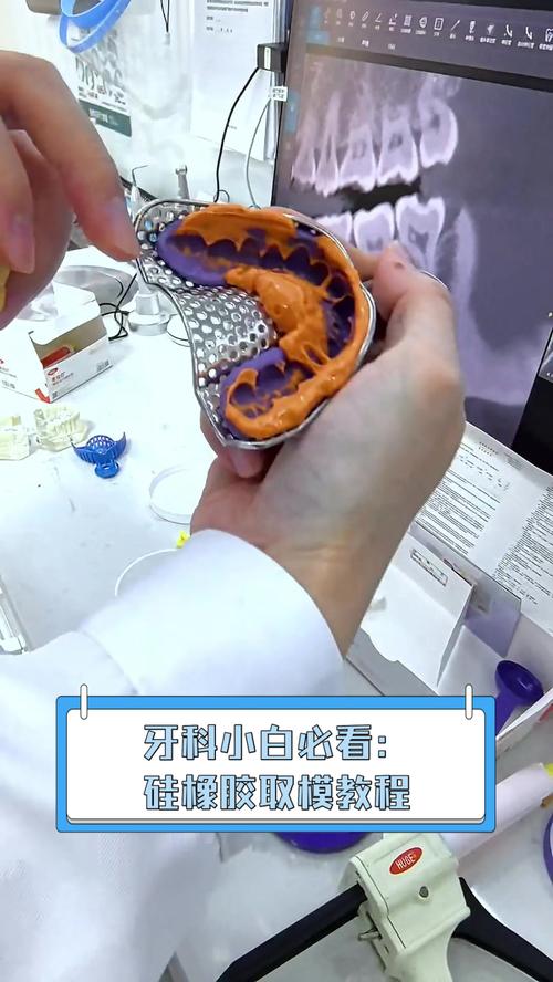 活动牙取模的具体方法步骤及注意事项有哪些？-图2