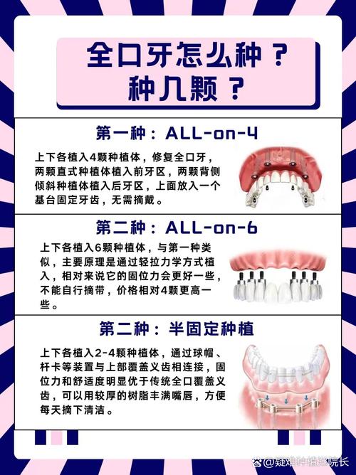 种牙的方式有哪些-图1 种牙的方式有哪些-图1