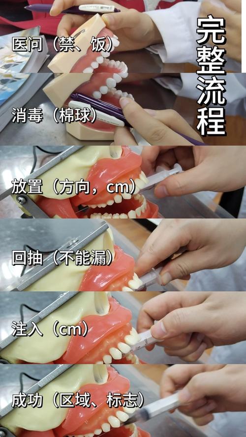 种牙常用的麻醉方法有哪些?如何选择合适麻醉?-图1 种牙常用的麻醉方法有哪些?如何选择合适麻醉?-图1