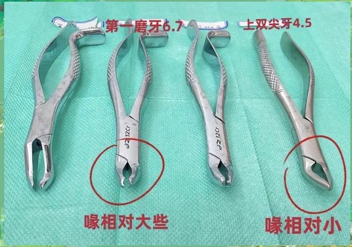 先进拔牙方法如何提升拔牙体验与安全性？-图3