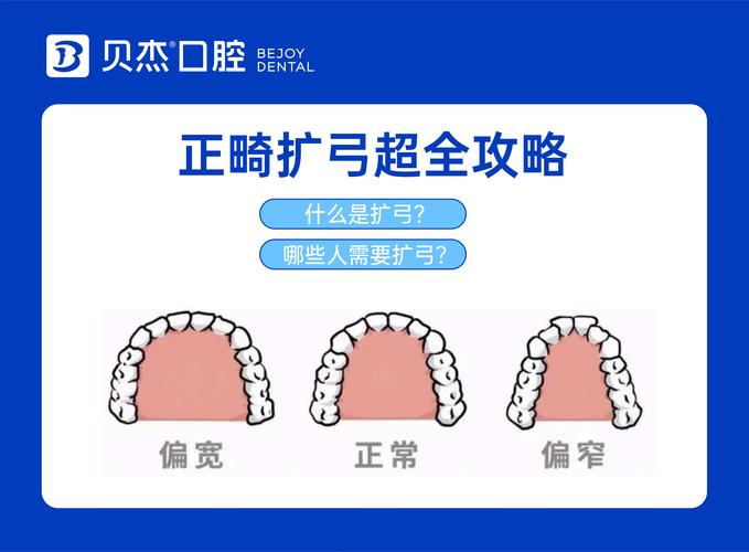 扩张牙的治疗方法哪种更安全有效？-图3