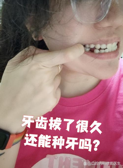 刚拔完牙能种牙吗?即刻种植时机合适吗?-图3 刚拔完牙能种牙吗?即刻种植时机合适吗?-图3