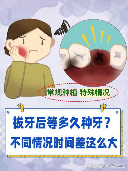 拔牙后种牙要等多久？最佳时间是什么时候？-图3