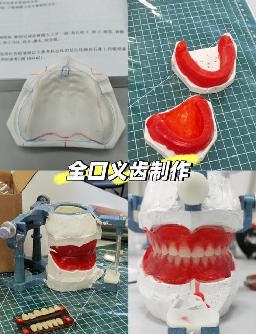 义齿装盒方法的关键步骤及注意事项是什么？-图1