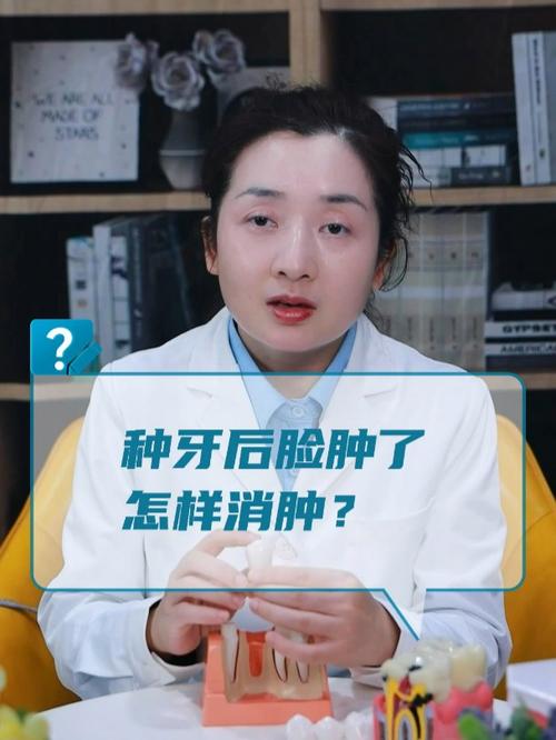 种牙后一定会肿吗-图3