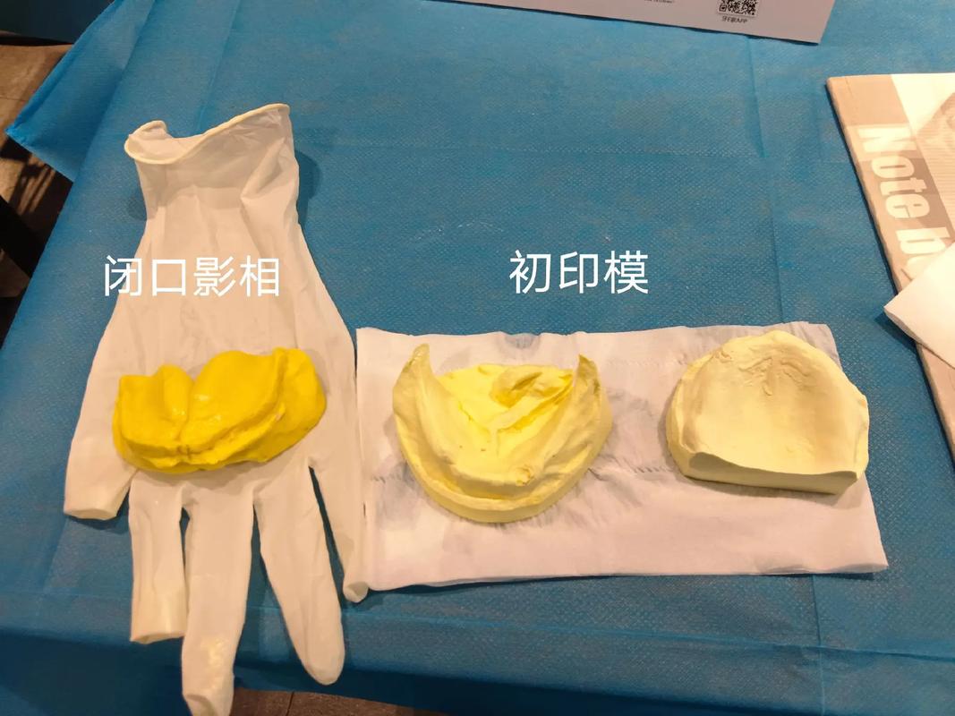 闭口式印模方法如何提升取模精准度？-图3