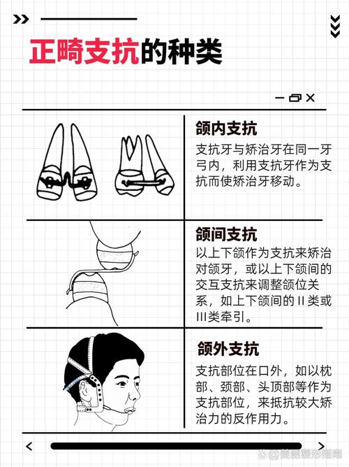 正畸弱支抗方法如何高效实现精准矫治？-图1
