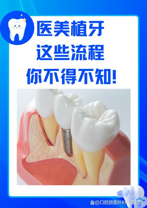 种牙后多久能恢复到可以正常上班的状态呢？-图2