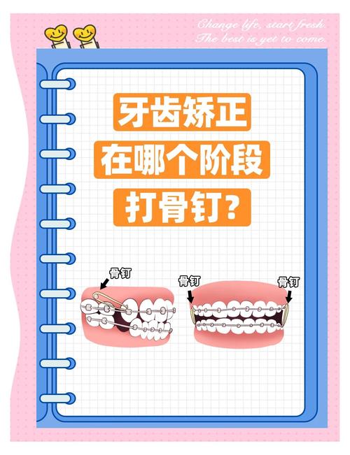 1017杭州正畸课程能学到哪些实用正畸技术？-图2
