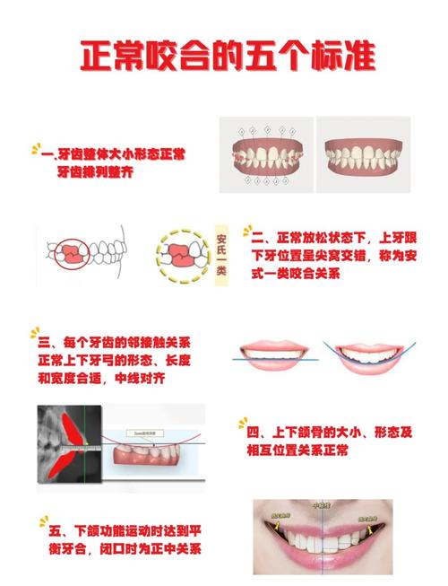咬合检查的方法有哪些具体步骤?-图1 咬合检查的方法有哪些具体步骤?-图1