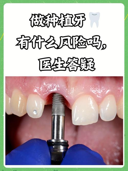 牙缝太小能种牙吗-图1