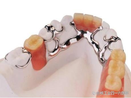 种牙临时牙冠戴法-图2
