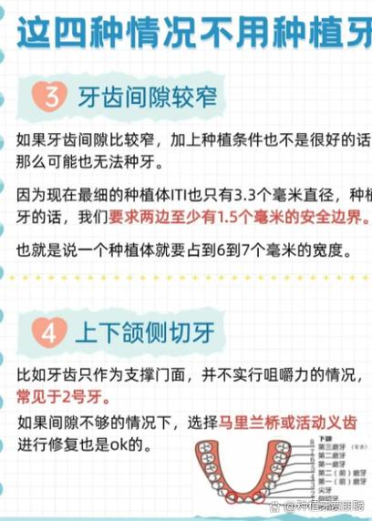 没有真牙的情况下，是否还能进行种植牙治疗呢？-图3