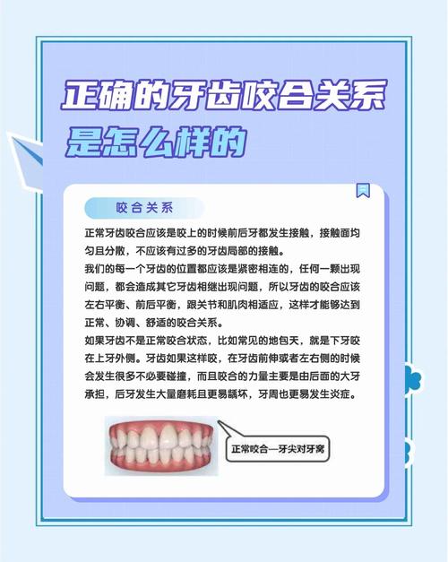 改变咬合的方法有哪些？如何选择适合的？-图3