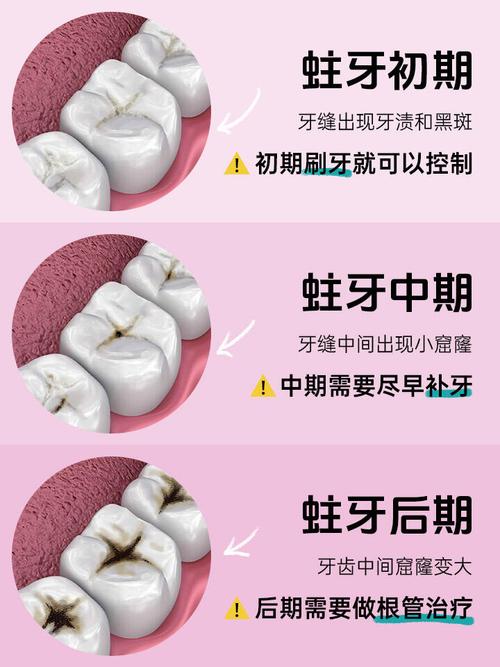 蛀牙洞土方法真的能修复吗？安全吗？-图1